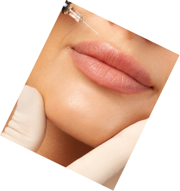 Injections et fillers