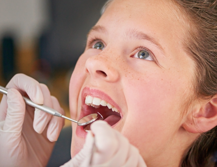 Déroulement de l’application du scellant dentaire