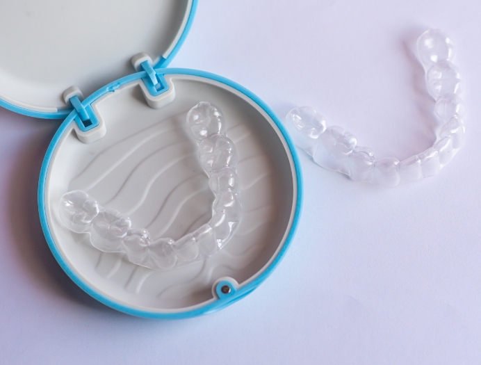 Une approche discrète pour améliorer l’alignement dentaire